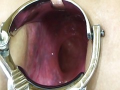 Elmer Wife Extreme Anal Speculum Play